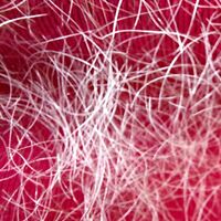 ausgefallene Haare auf dem T-Shirt. Foto: privat